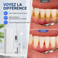 Set de nettoyeur de dents à ultrasons portable et de détartreur dentaire